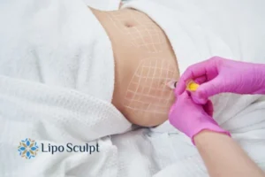 Are The Results From Aqualyx Permanent? 1 Do you want to know how long Aqualyx Bedford results last?