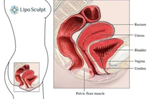 Treatment For A Leaky Bladder 2 How EM Chair treatment Bedford can help Leaky bladder issues. Read more now!