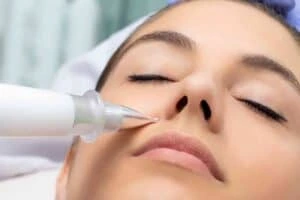 Best Actinic Keratoses Removal 3 Actinic keratoses Bedford solutions - book in today!