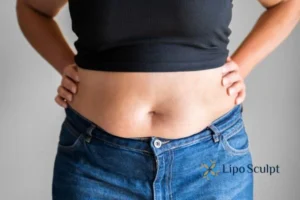 Bidding Farewell to Muffin Tops with Aqualyx Fat Injections 2 Do you wish you could reduce your muffin top Bedford With Aqualy fat dissolving injections you can!